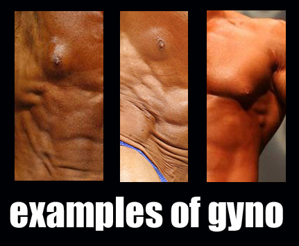 gyno-bodybuilder